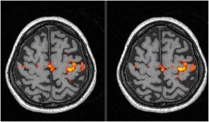 Attivazione neuromotoria (fMRI BOLD)